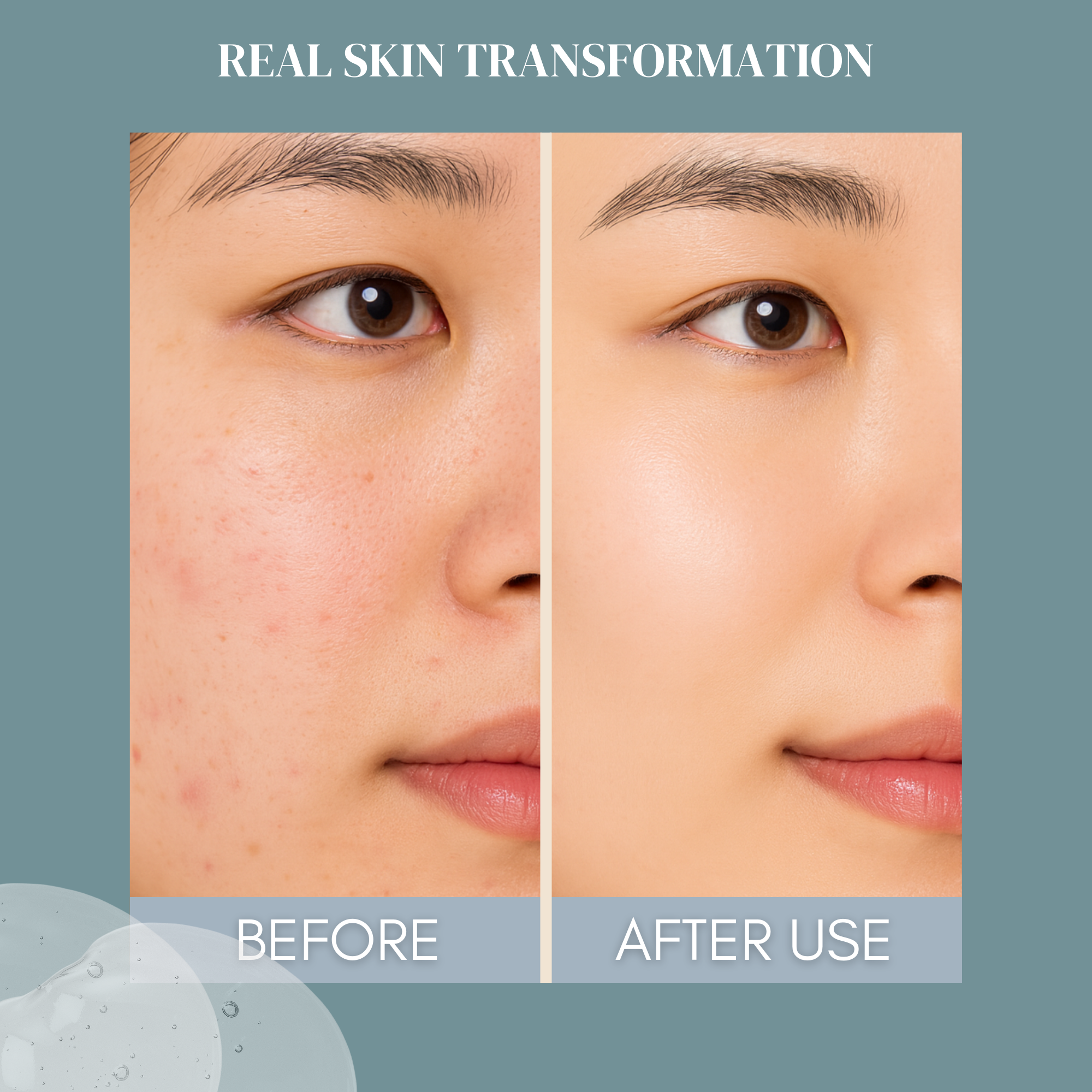 CONSLY Post Acne Toner Essence - Snail Mucin & Niacinamide | 6,76 fl.oz