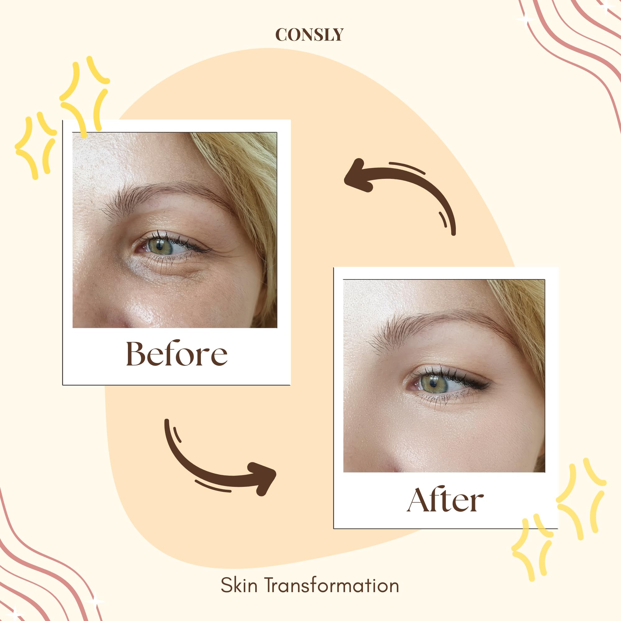 CONSLY Reboot Your Eyes Collagen Eye Patches | 150 pcs / 20 ml / 0.67 fl oz